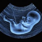 آثار سو لغو “اجبار” در غربالگری دوران بارداری