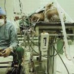 تصویری جالب از عمل پیوند قلب بعد از ۲۳ ساعت جراحی