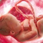 غربالگری ژنتیک جنین حذف نشده است